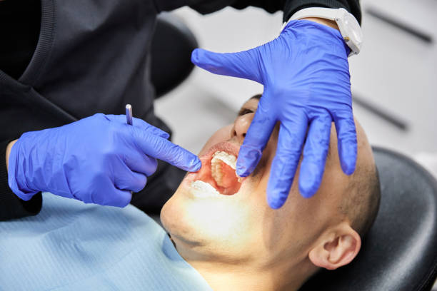 Best Emergency Root Canal Treatment in Crooksville, OH